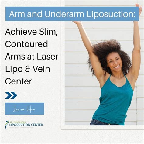 liposuction cost st louis|Liposuction St. Louis, MO 